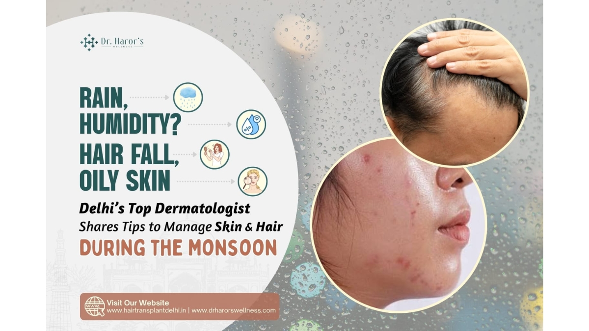 PNN-90-1 Rain, Humidity, Hair Fall, Oily Skin? Delhi’s Top Dermatologist Shares Tips to Manage Skin & Hair During the Monsoon